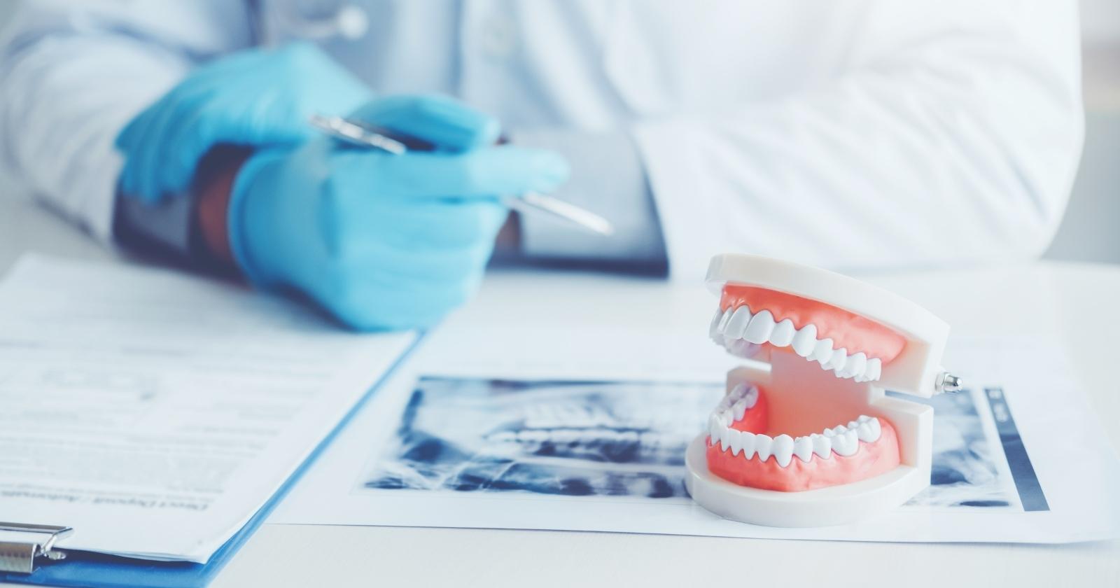 Veneers vs Invisalign | What You Need to Know